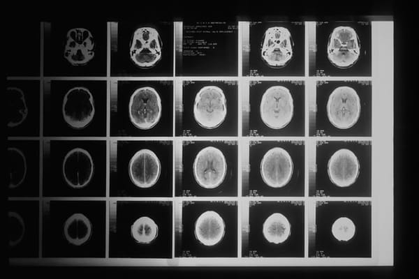 The poweful applications of deep learning  in healthcare